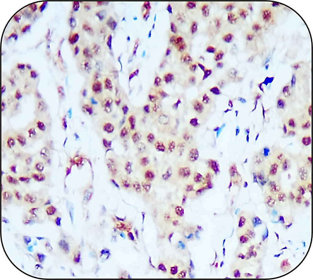 IR113-466 anti-HIF1 alpha antibody IHC image