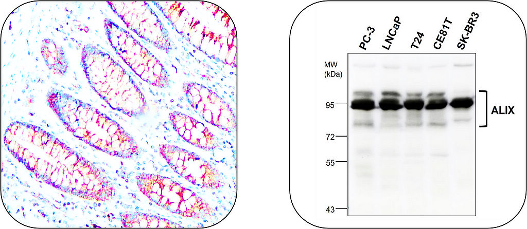 IR303-988 anti-ALIX antibody IHCand WB image