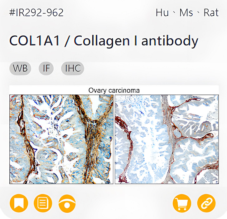 Markers of the Tumor Microenvironment related product IR292-962_COL1A1 / Collagen I antibody page link