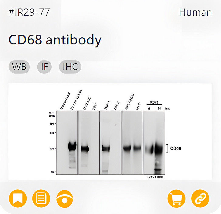 Markers of Immune cell related product IR29-77_CD68 antibody page link