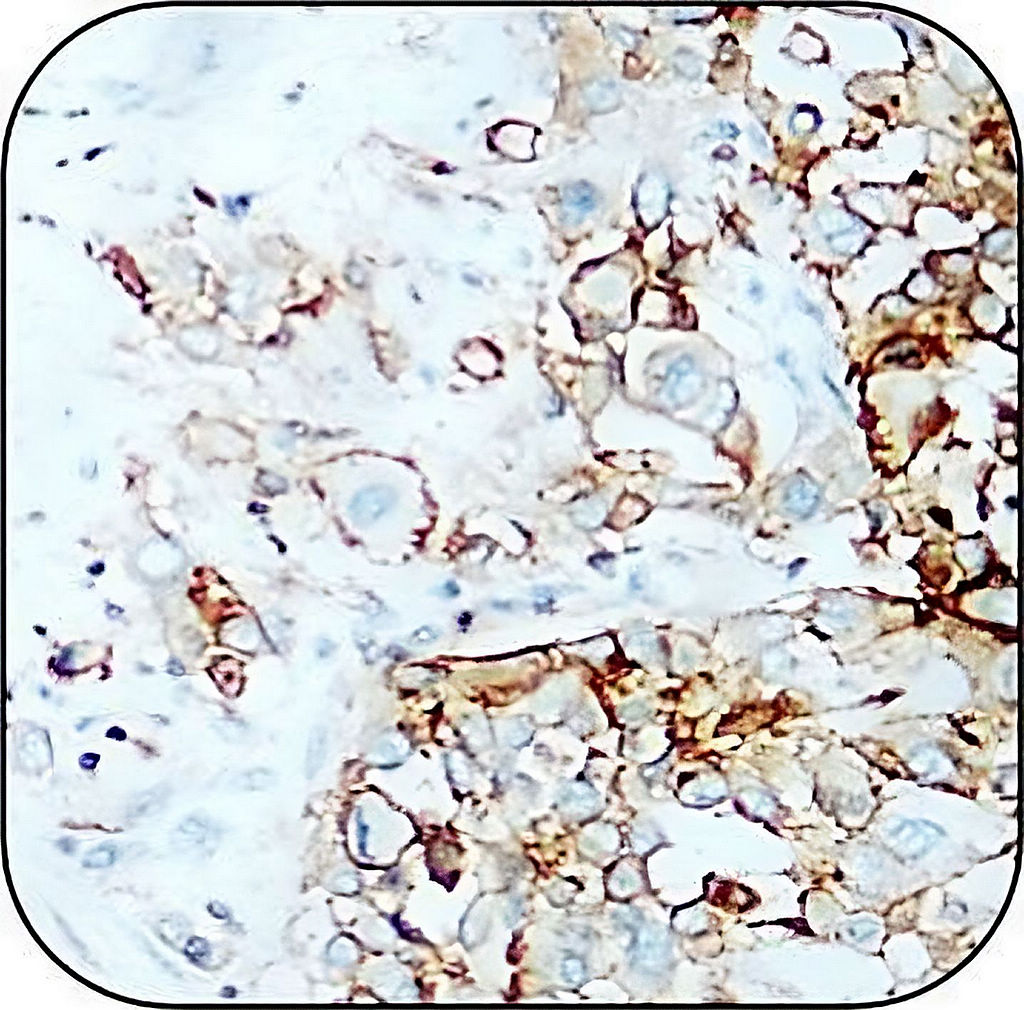 IR208-752 anti-CD44 antibody IHC image