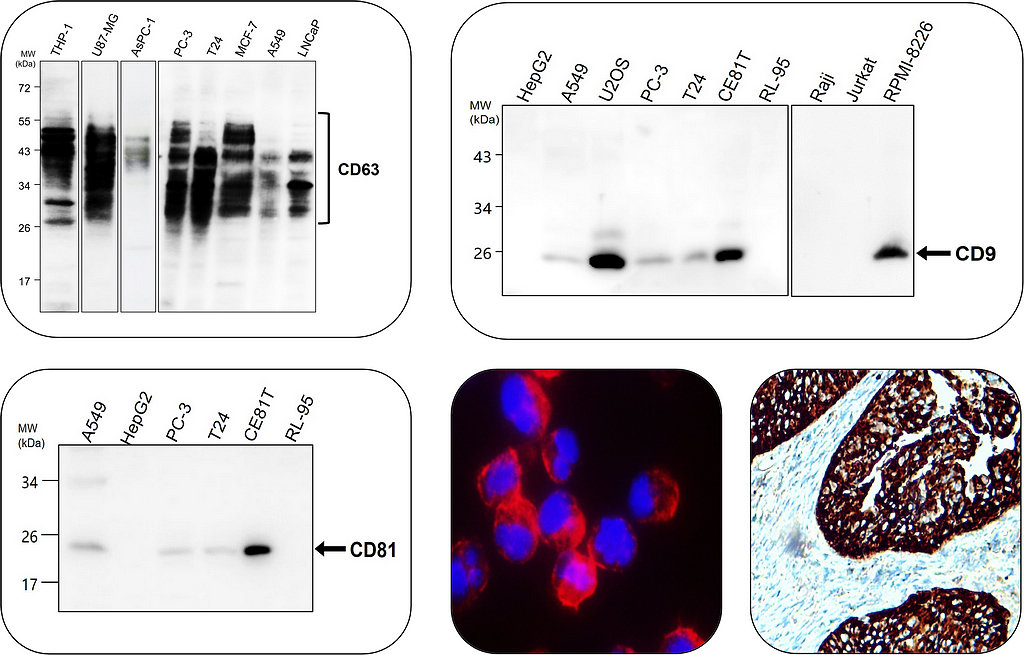 General Exosome Markers: Tetraspanins