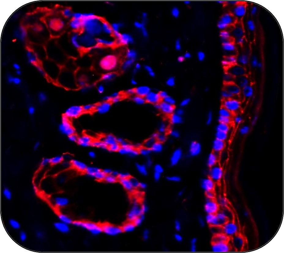 IR49-149 anti-Beta Catenin antibody_IF_Customer feedback