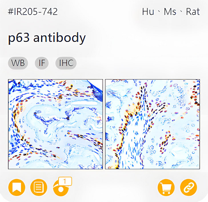 Oncology Biomarkers related product IR205-742_p63 antibody page link