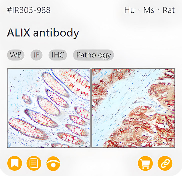 Markers of Exosome related product IR303-988_ALIX antibody page link