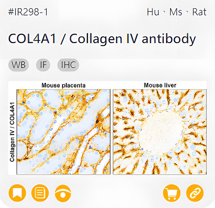 Markers of the Tumor Microenvironment related product IR298-1_COL4A1 / Collagen IV antibody page link