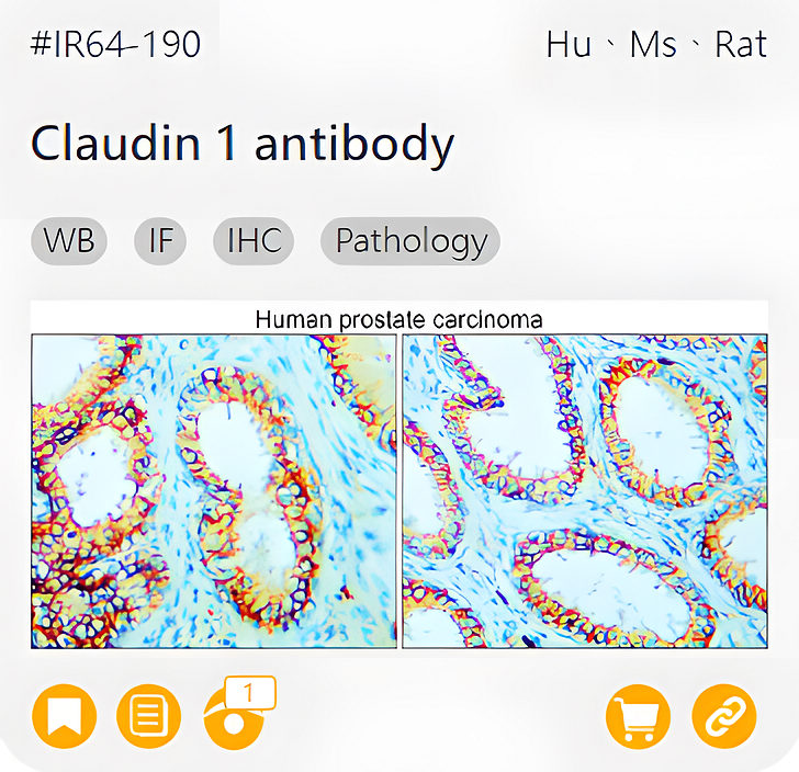 Markers of Epithelial to Mesenchymal Transition related product IR64-190_Claudin 1 antibody page link