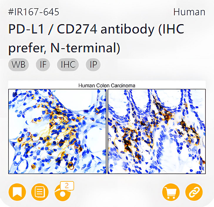 Markers of Immune cell related product IR167-645_PD-L1 / CD274 antibody (IHC prefer, N-terminal) page link