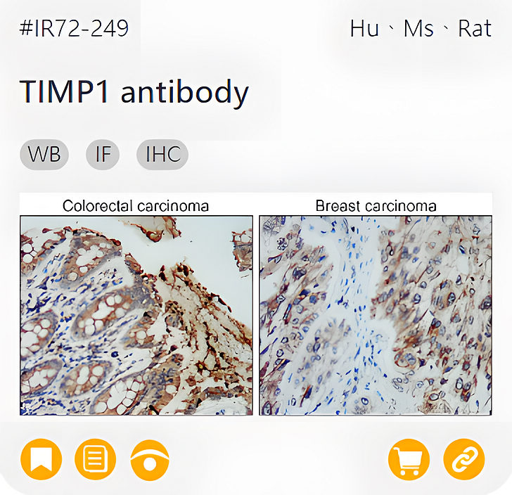 Markers of the Tumor Microenvironment related product IR72-249_TIMP1 antibody page link