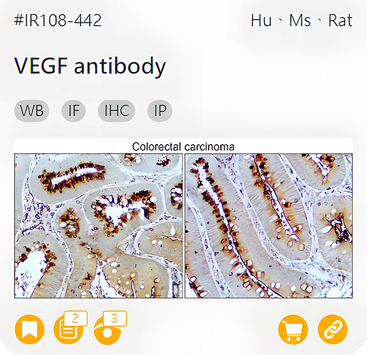 Markers of the Tumor Microenvironment related product IR108-442_VEGF antibody page link