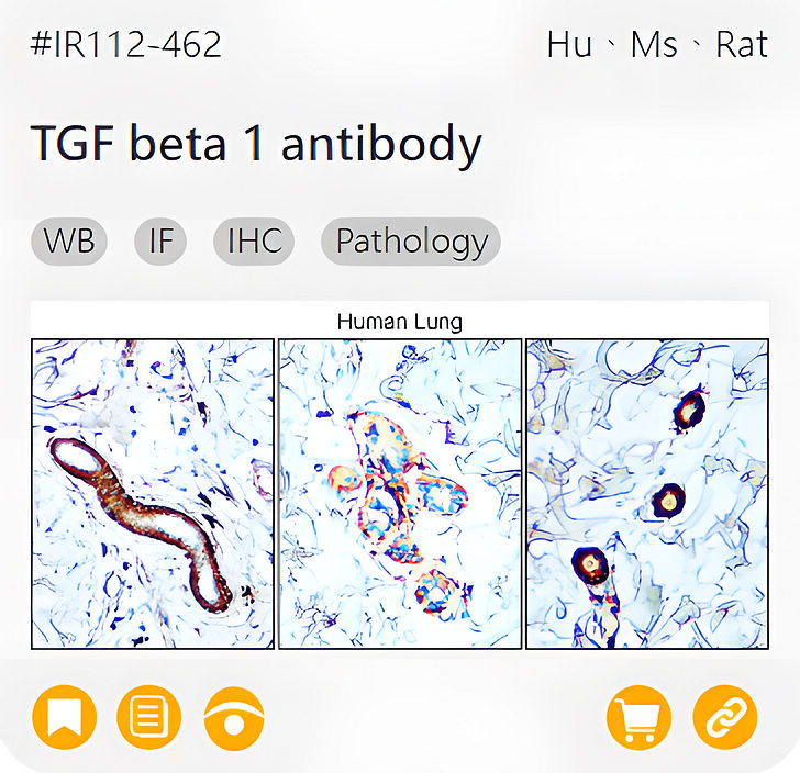 Markers of the Tumor Microenvironment related product IR112-462_TGF beta 1 antibody page link