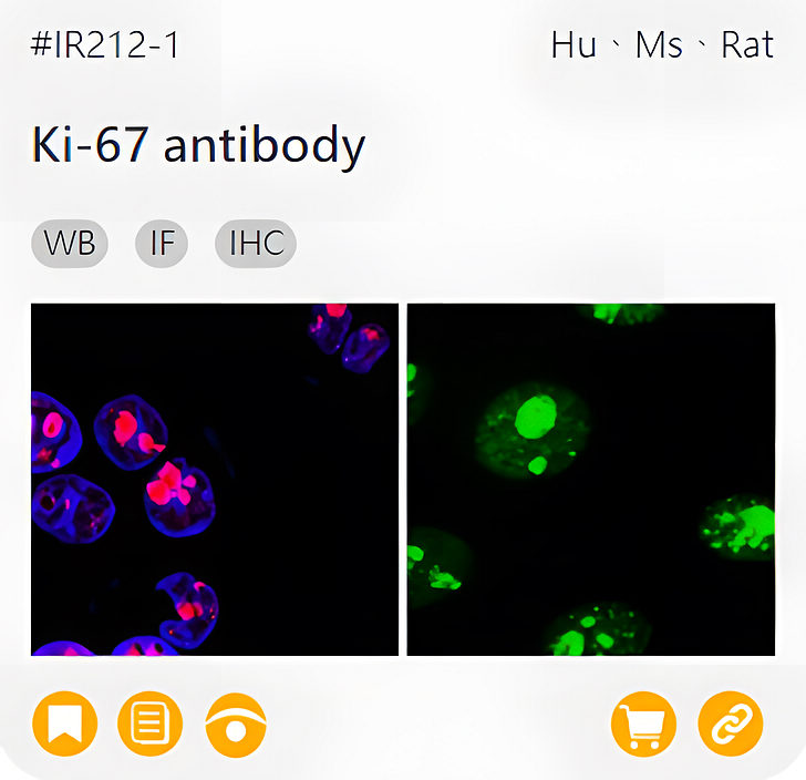 Oncology Biomarkers related product IR212-1_Ki-67 antibody page link