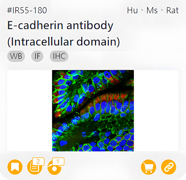 Markers of Epithelial to Mesenchymal Transition related product IR55-180_E-cadherin antibody (Intracellular domain) page link