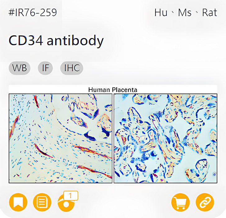 Markers of the Tumor Microenvironment related product IR76-259_CD34 antibody page link