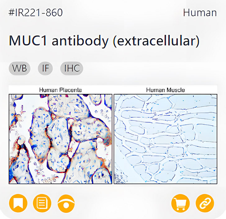 Oncology Biomarkers related product IR221-860_MUC1 antibody (extracellular) page link