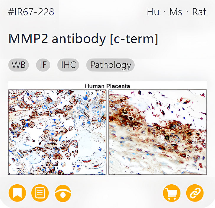 Markers of the Tumor Microenvironment related product IR67-228_MMP2 antibody [c-term] page link