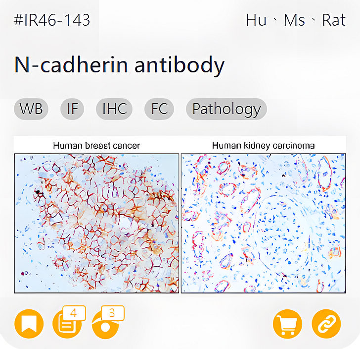 Markers of Epithelial to Mesenchymal Transition related product IR46-143_N-cadherin antibody page link