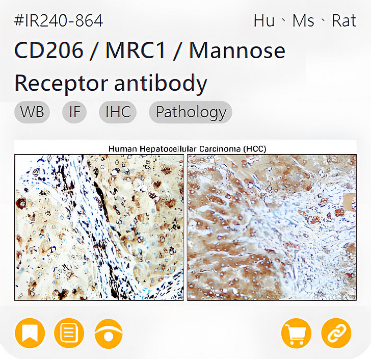 Markers of Immune cell related product IR240-864_CD206 / MRC1 / Mannose Receptor antibody page link