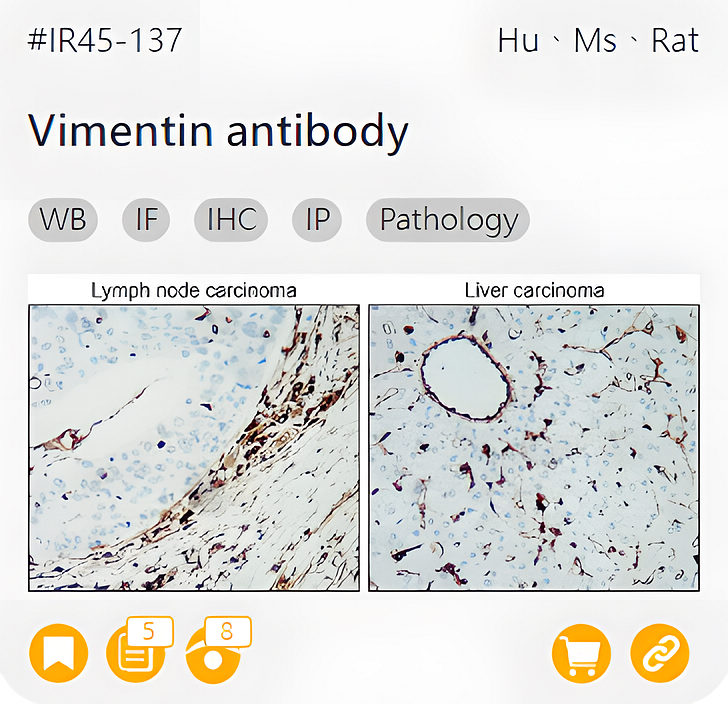 Markers of Epithelial to Mesenchymal Transition related product IR45-137_Vimentin antibody page link