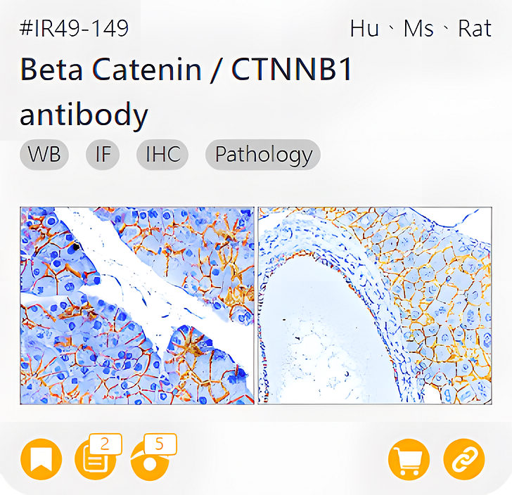 Markers of Epithelial to Mesenchymal Transition related product IR49-14_Beta Catenin / CTNNB1 antibody page link