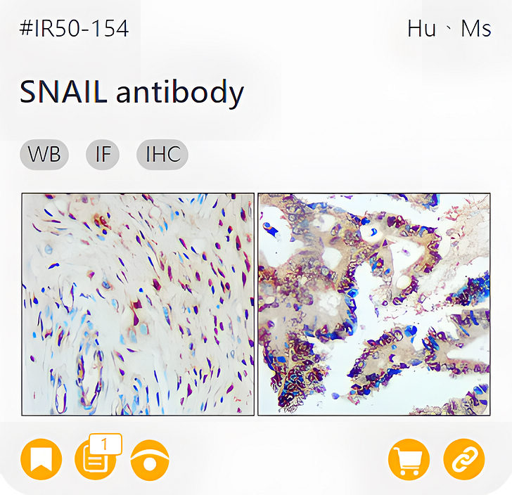 Markers of Epithelial to Mesenchymal Transition related product IR50-154_SNAIL antibody page link