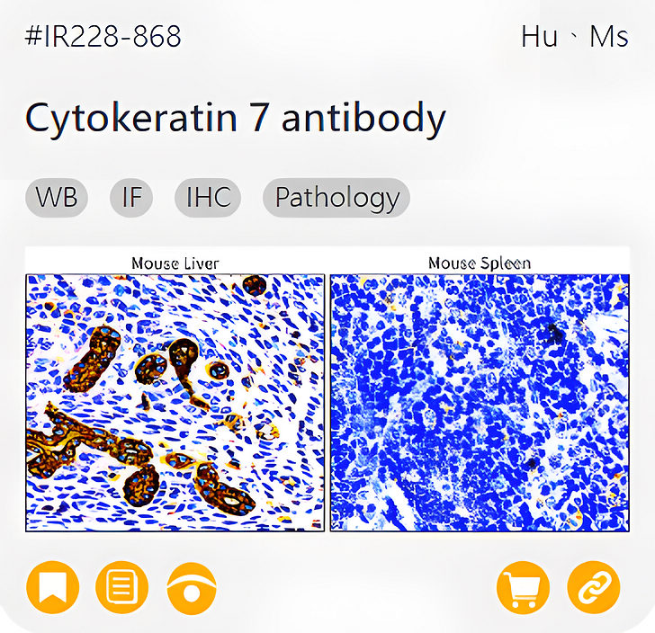 Oncology Biomarkers related product IR228-868_Cytokeratin 7 antibody page link