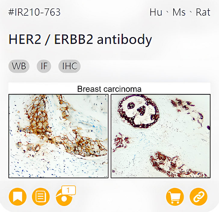 Oncology Biomarkers related product IR210-763_HER2 / ERBB2 antibody page link