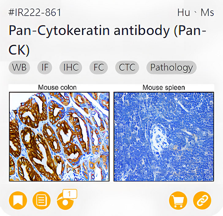 Oncology Biomarkers related product IR222-861_Pan-Cytokeratin antibody (Pan-CK) page link