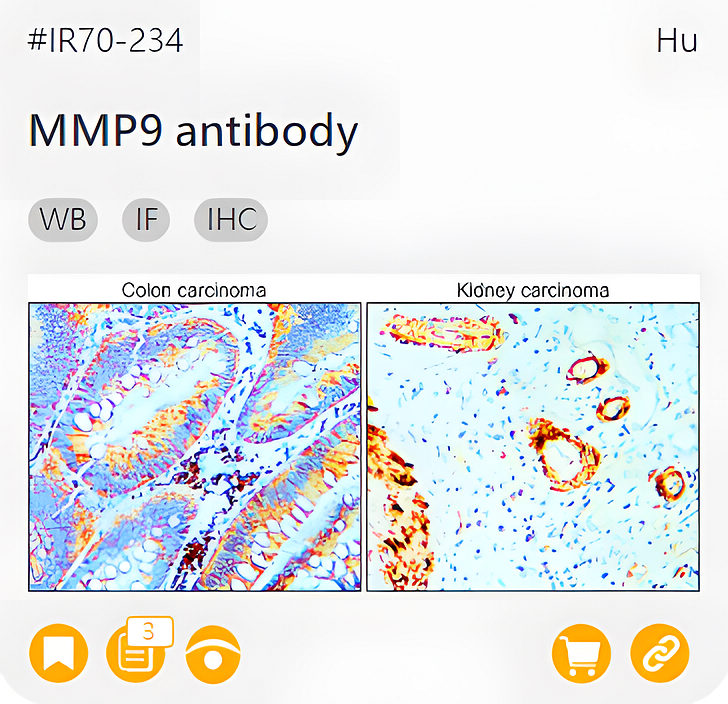 Markers of the Tumor Microenvironment related product IR70-234_MMP9 antibody page link