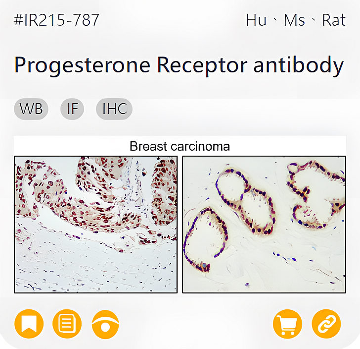 Oncology Biomarkers related product IR215-787_Progesterone Receptor antibody page link