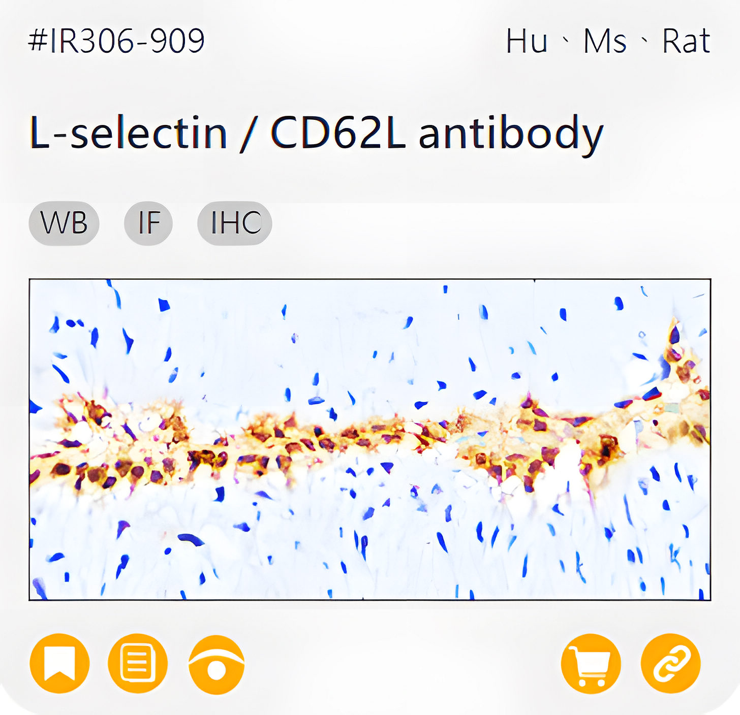 Markers of Immune cell related product IR306-909_L-selectin / CD62L antibody page link