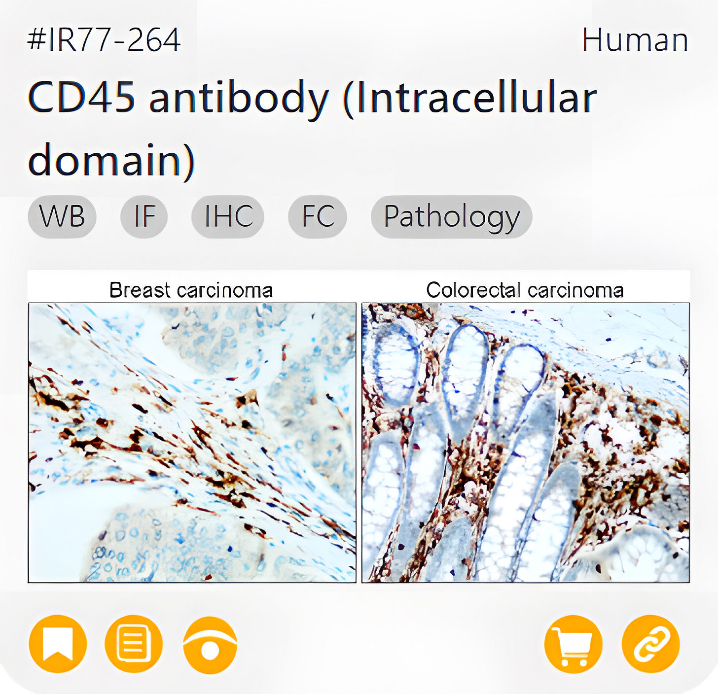 Markers of Immune cell related product IR77-264_CD45 antibody (Intracellular domain) page link