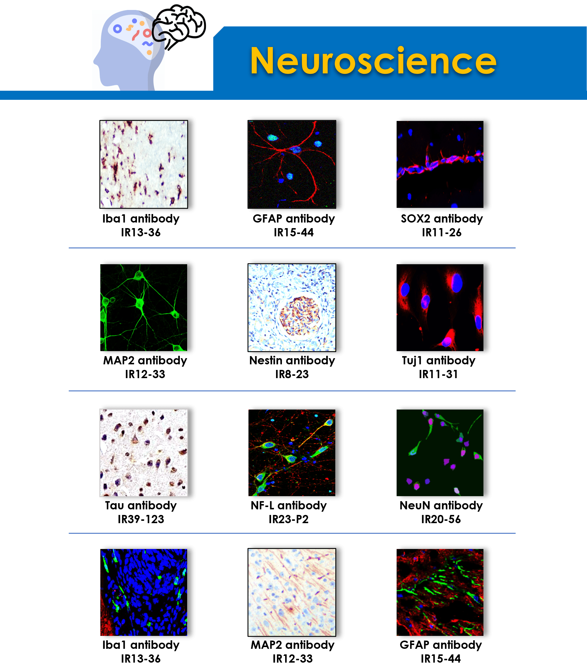 neuroscience antibodies list