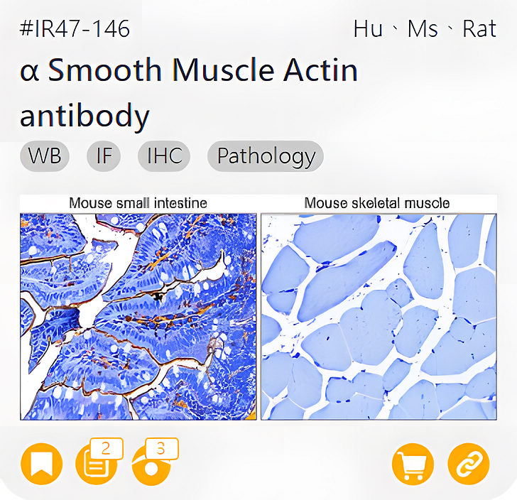 Markers of the Tumor Microenvironment related product IR47-146_α Smooth Muscle Actin antibody page link