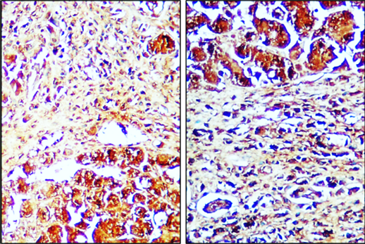 IR99-409 anti-Caspase8 antibody IHC image 