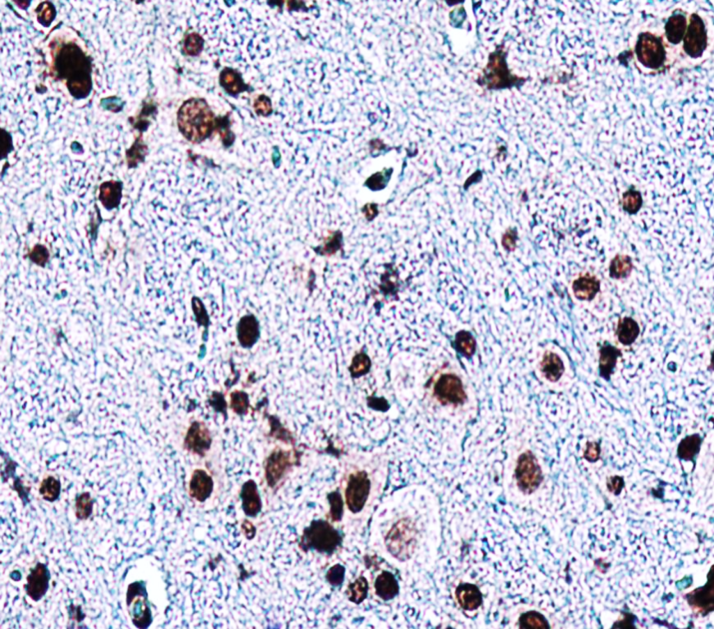 IR6-17 anti-PAX6 antibody IHC image