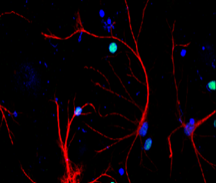 Customer feedback Image IR15-44 anti-GFAP antibody IF image