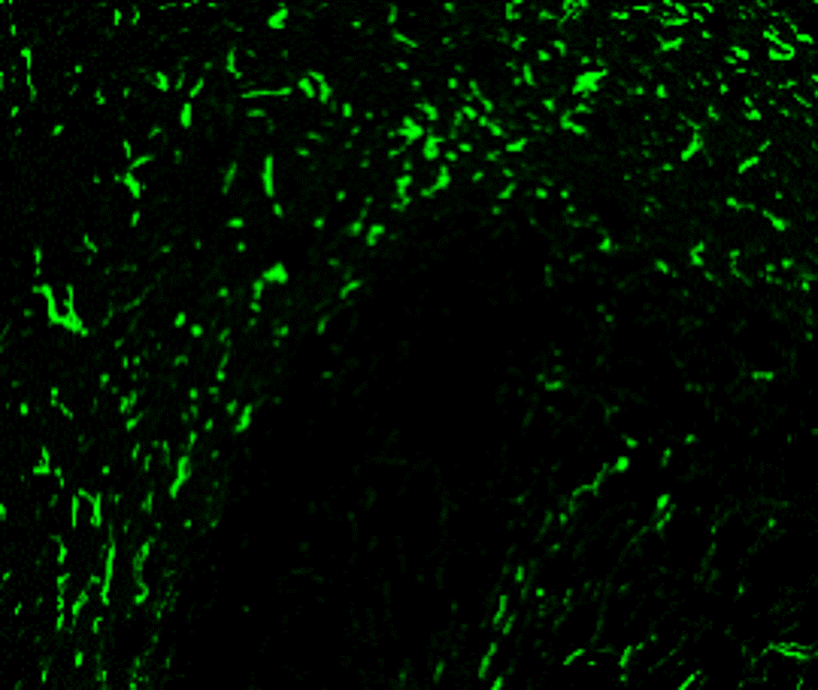 Customer feedback Image IR15-44 anti-GFAP antibody IHC image