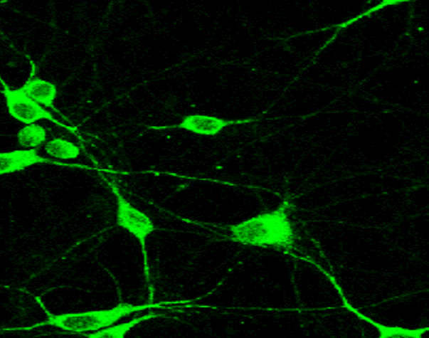 IR21-57 anti-NF-H antibody IF image