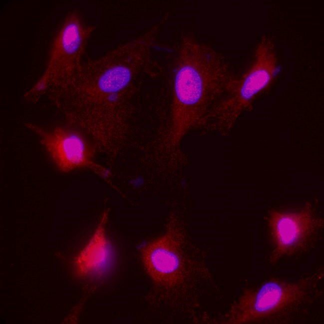 IR21-57 anti-NF-H antibody ICC/IF image