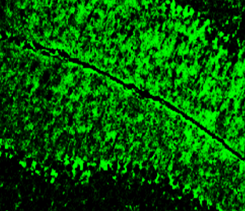 IR21-57 anti-NF-H antibody IHC image