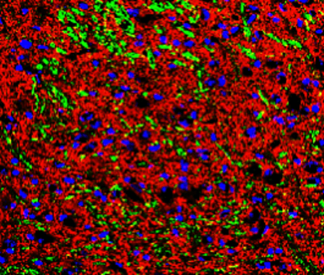 Customer feedback Image IR41-124 anti-Phospho-Tau (Thr181) antibody IHC image