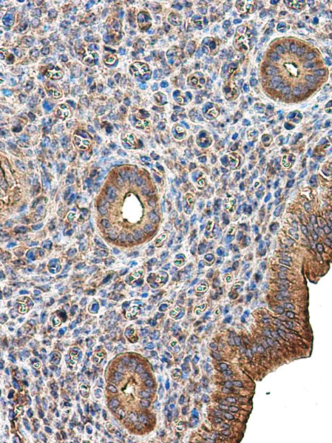 IR58-200 anti-FAK / PTK2 antibody IHC image