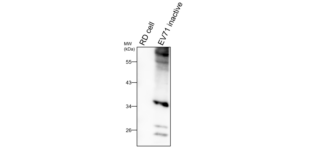 enterovirus-71-ev71-antibody-irv002-ireal-biotechnology-inc