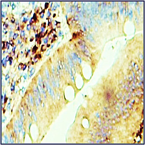 MMP9 antibody