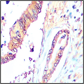 MMP1 antibody