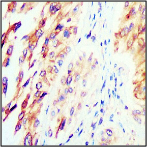 TIMP1 antibody