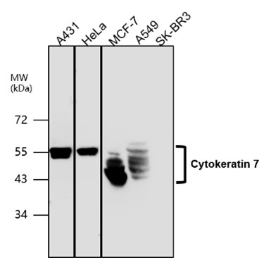 Cytokeratin 7 antibody