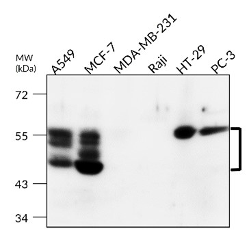 Cytokeratin 8 antibody