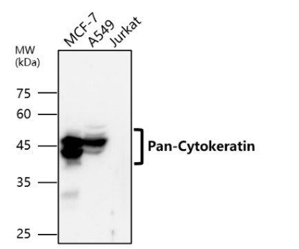 Pan-Cytokeratin antibody